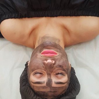 Laser peeling in cosmetology "Touch Light Cosmetology" Kiev. Sign up for laser peeling at a discount.