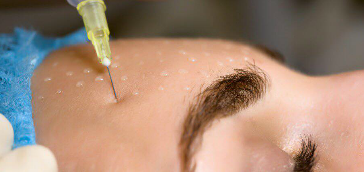 Injections