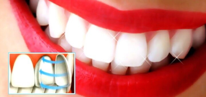 Nazaria Dental