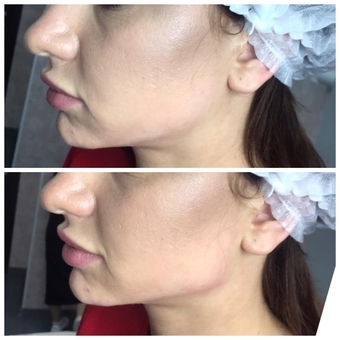 Косметолог Олена Кузьменко в Києві. процедури для шкіри знижки.