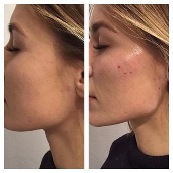 Косметолог Олена Кузьменко в Києві. процедури для шкіри недорого.