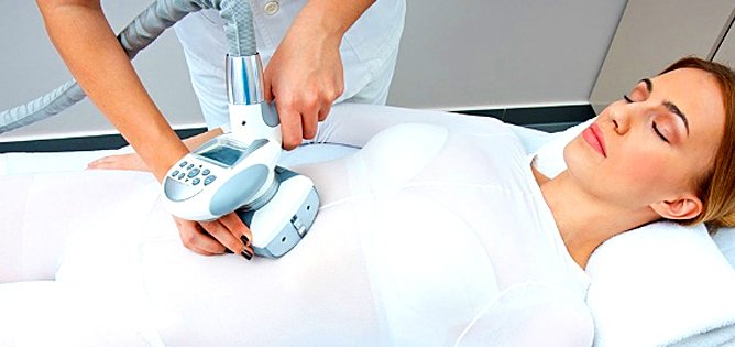 LPG масаж у салоні краси «Монблан» у Києві на Оболоні. Записуйтесь на процедури корекції фігури зі знижкою.